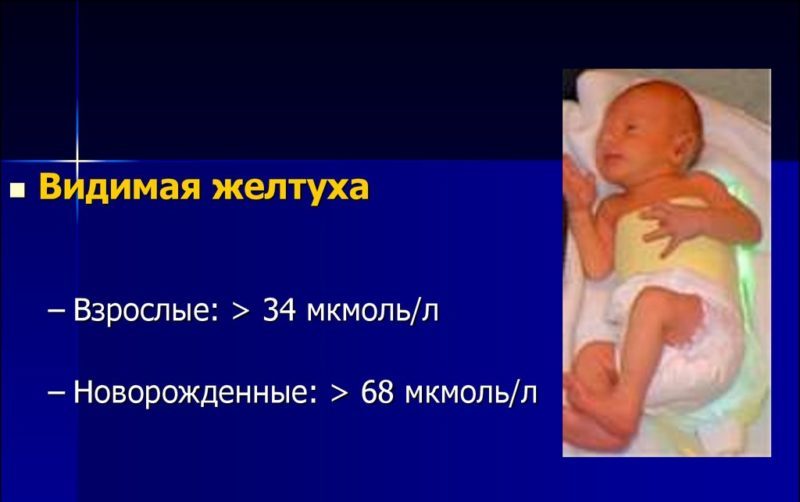 Как меняется изображение прорези на колпачке лампы при удалении лампы от линзы