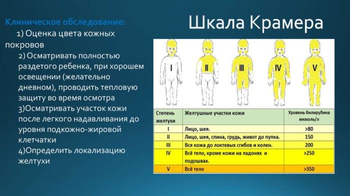 Цвет стула при желтухе